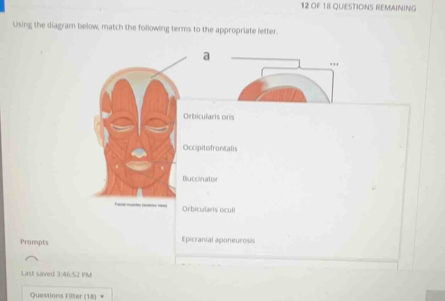 using the diagram below, match the following terms to the appropriate l…