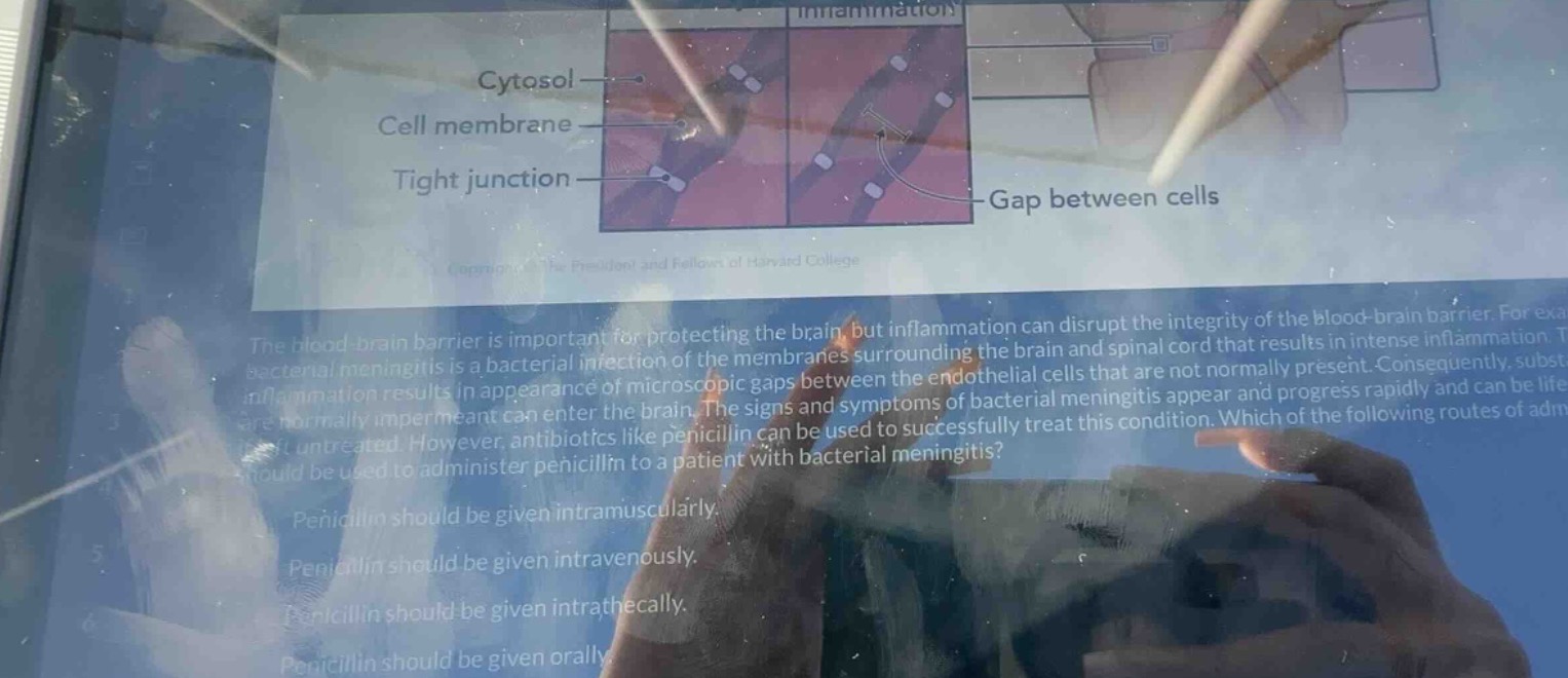 the blood - brain barrier is important for protecting the brain, but in…