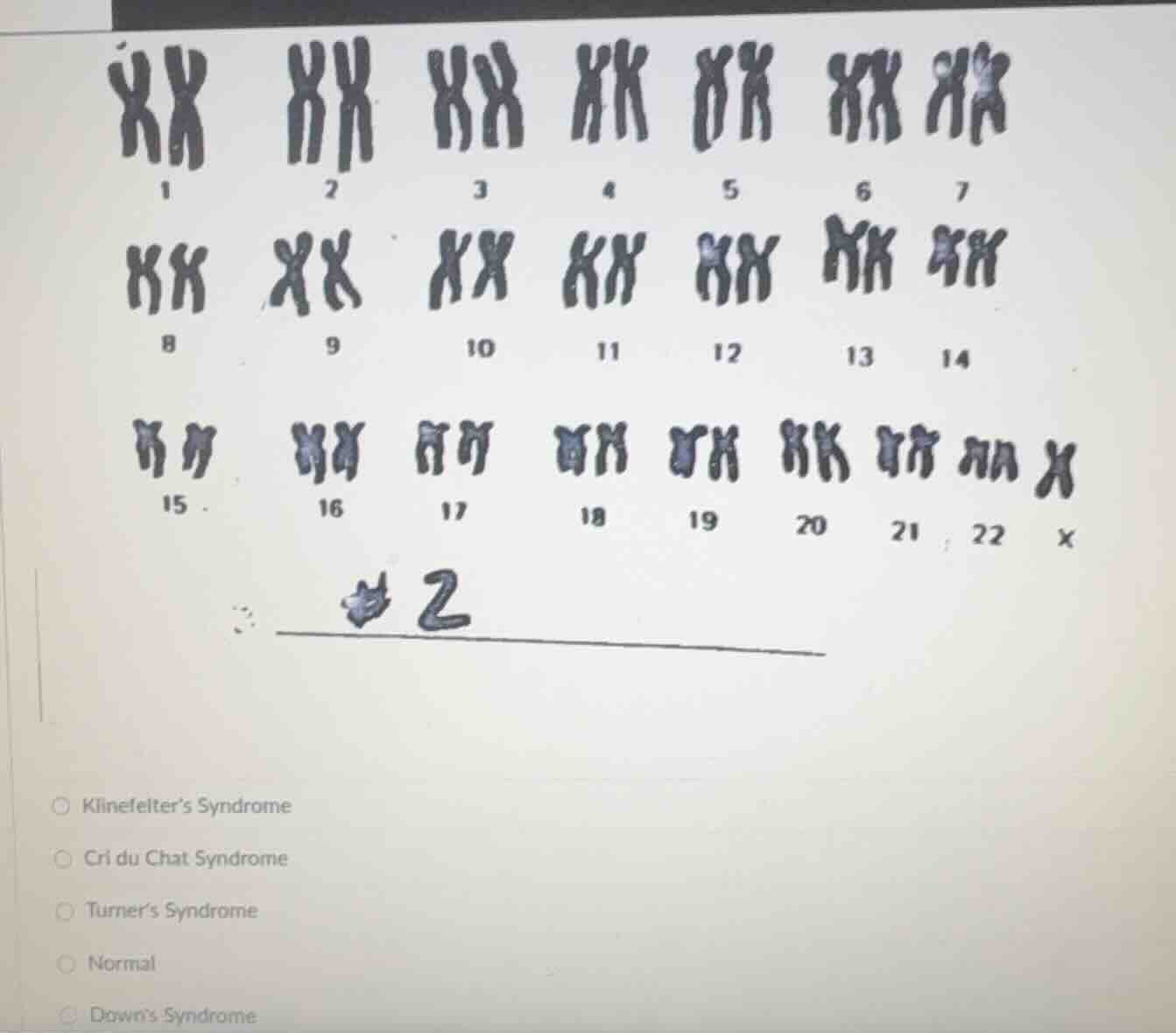 1 2 3 4 5 6 7 8 9 10 11 12 13 14 15 16 17 18 19 20 21 22 x klinefelters…