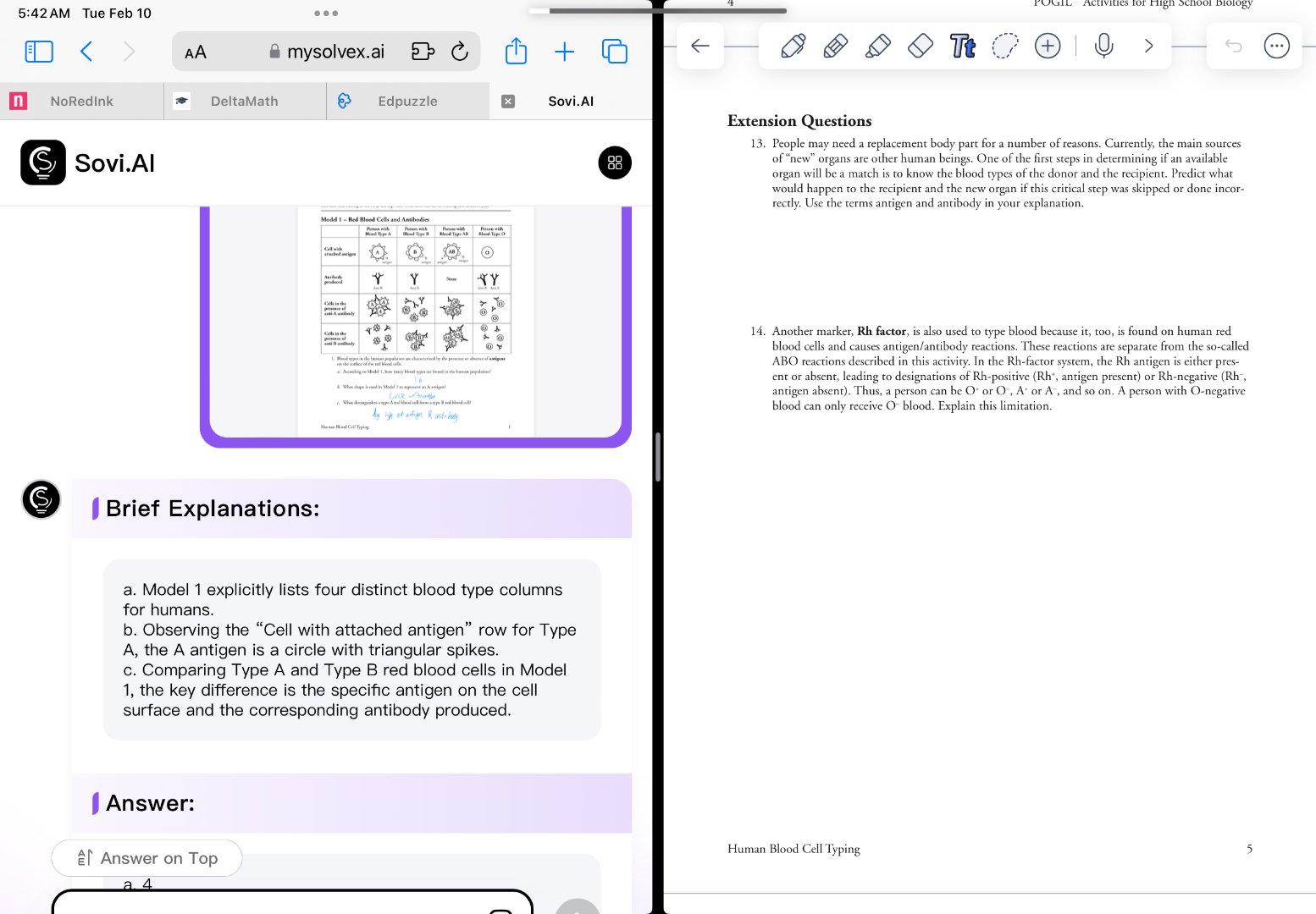 extension questions 13. people may need a replacement body part for a n…