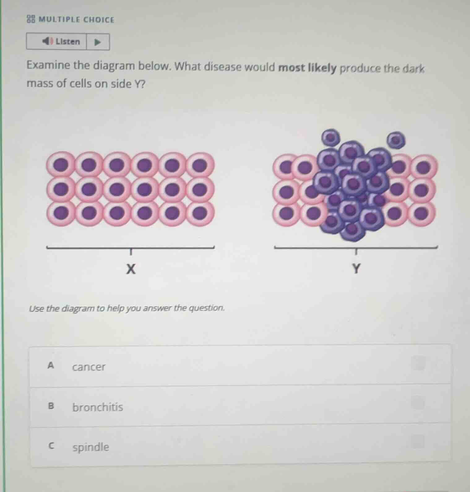 multiple choicelistenexamine the diagram below. what disease would most…