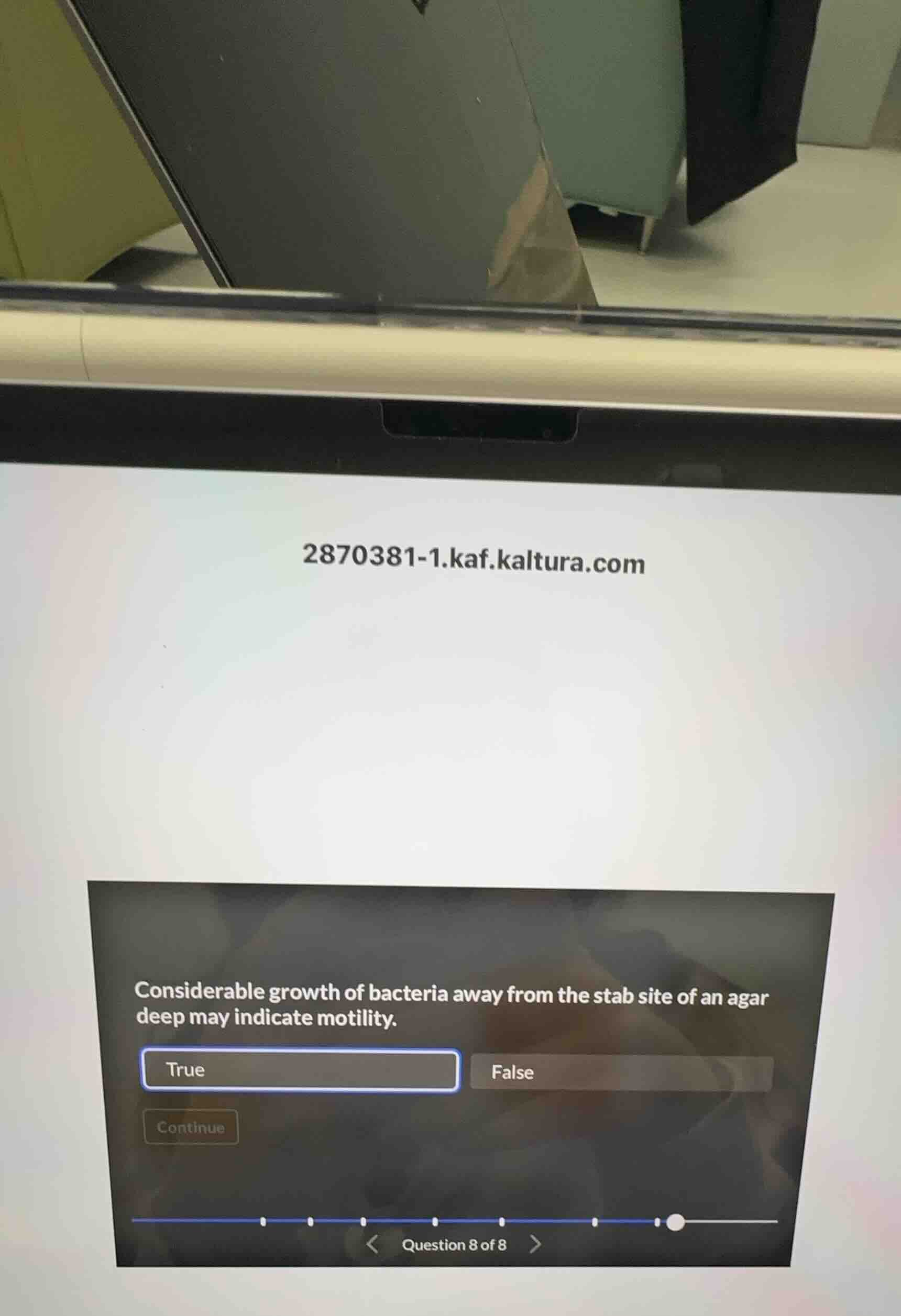 2870381-1.kaf.kaltura.com considerable growth of bacteria away from the…