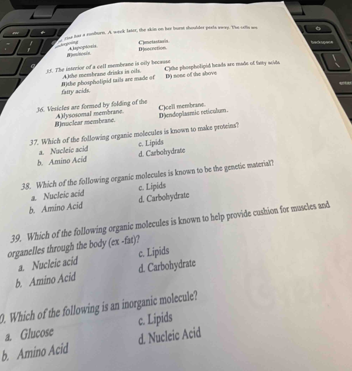 34. tina has a sunburn. a week later, the skin on her burnt shoulder pe…