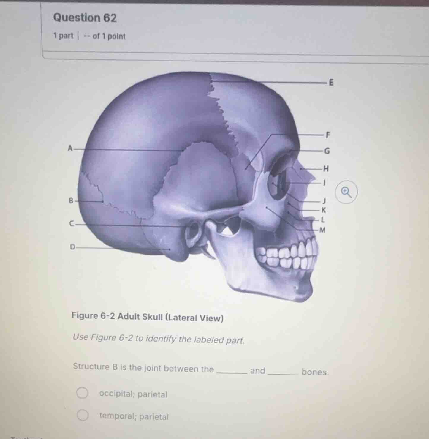 question 62 1 part | -- of 1 point figure 6-2 adult skull (lateral view…