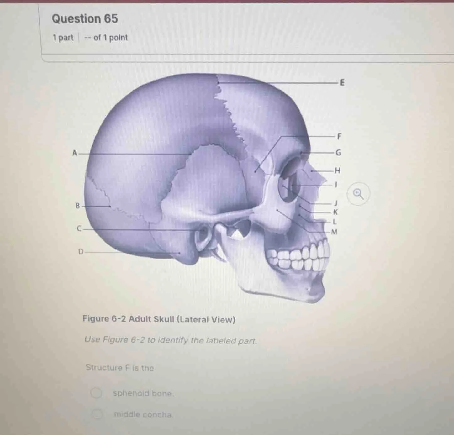 question 65 1 part | -- of 1 point figure 6-2 adult skull (lateral view…