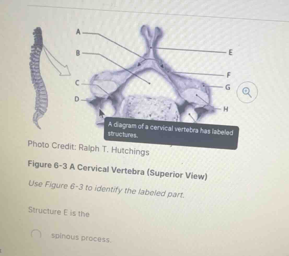photo credit: ralph t. hutchings figure 6-3 a cervical vertebra (superi…