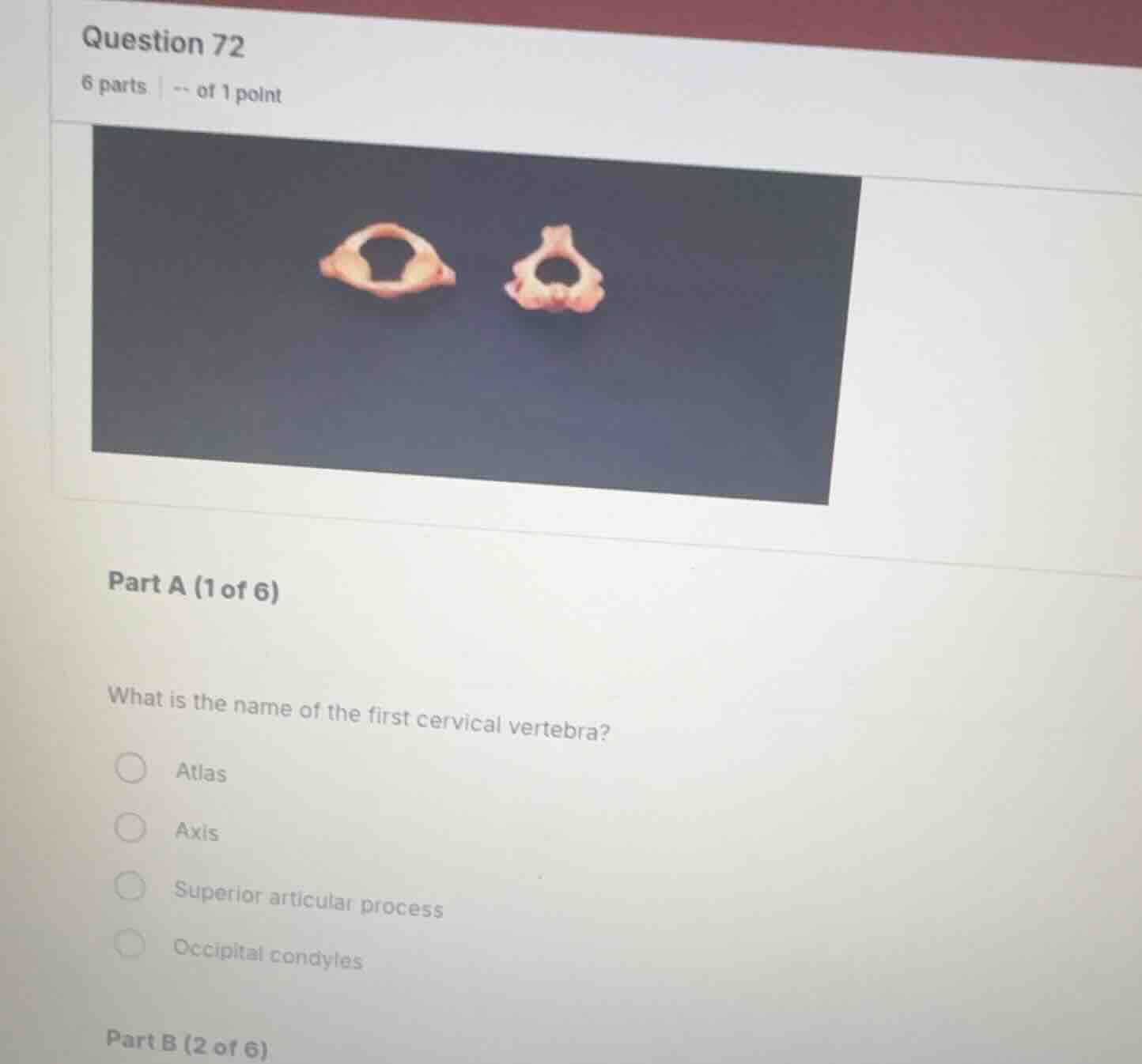 question 72 6 parts | -- of 1 point part a (1 of 6) what is the name of…