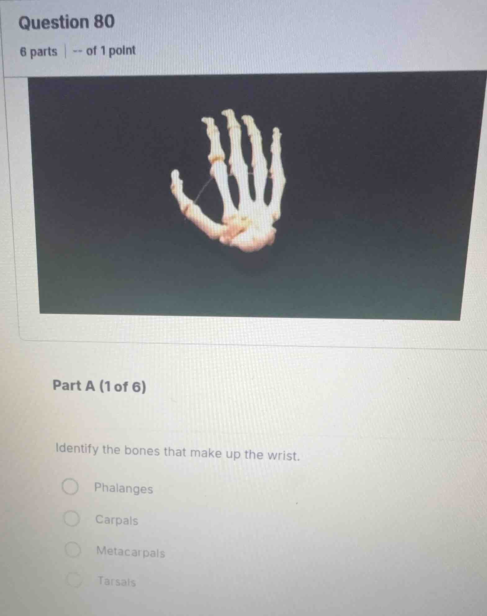 question 80 6 parts | -- of 1 point part a (1 of 6) identify the bones …