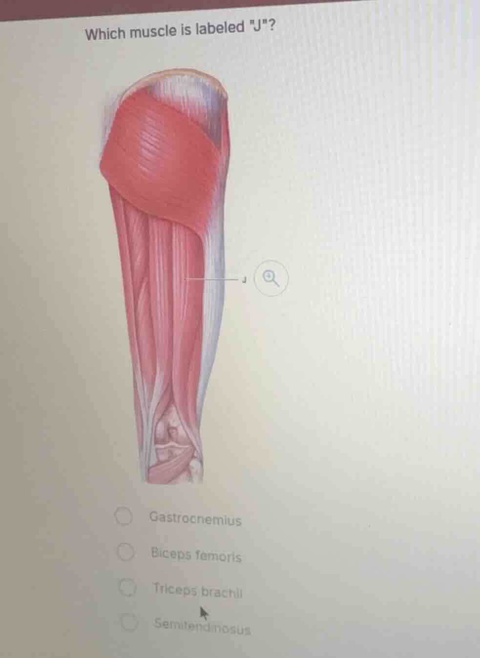 which muscle is labeled \j\?gastrocnemiusbiceps femoristriceps brachiis…