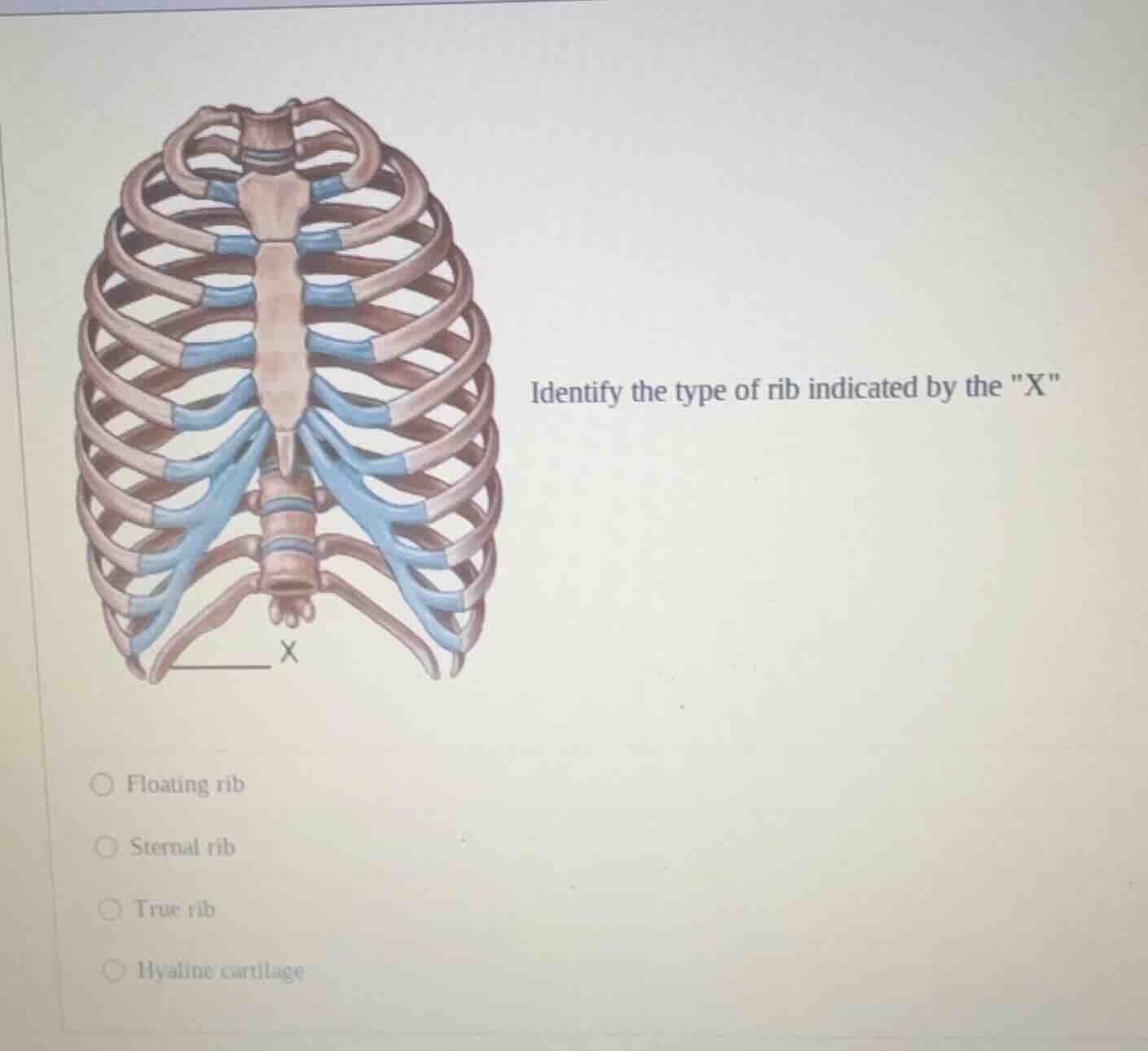 identify the type of rib indicated by the \x\○ floating rib○ sternal ri…