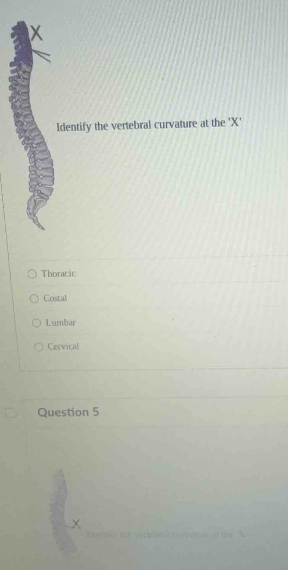 identify the vertebral curvature at the x thoracic costal lumbar cervic…