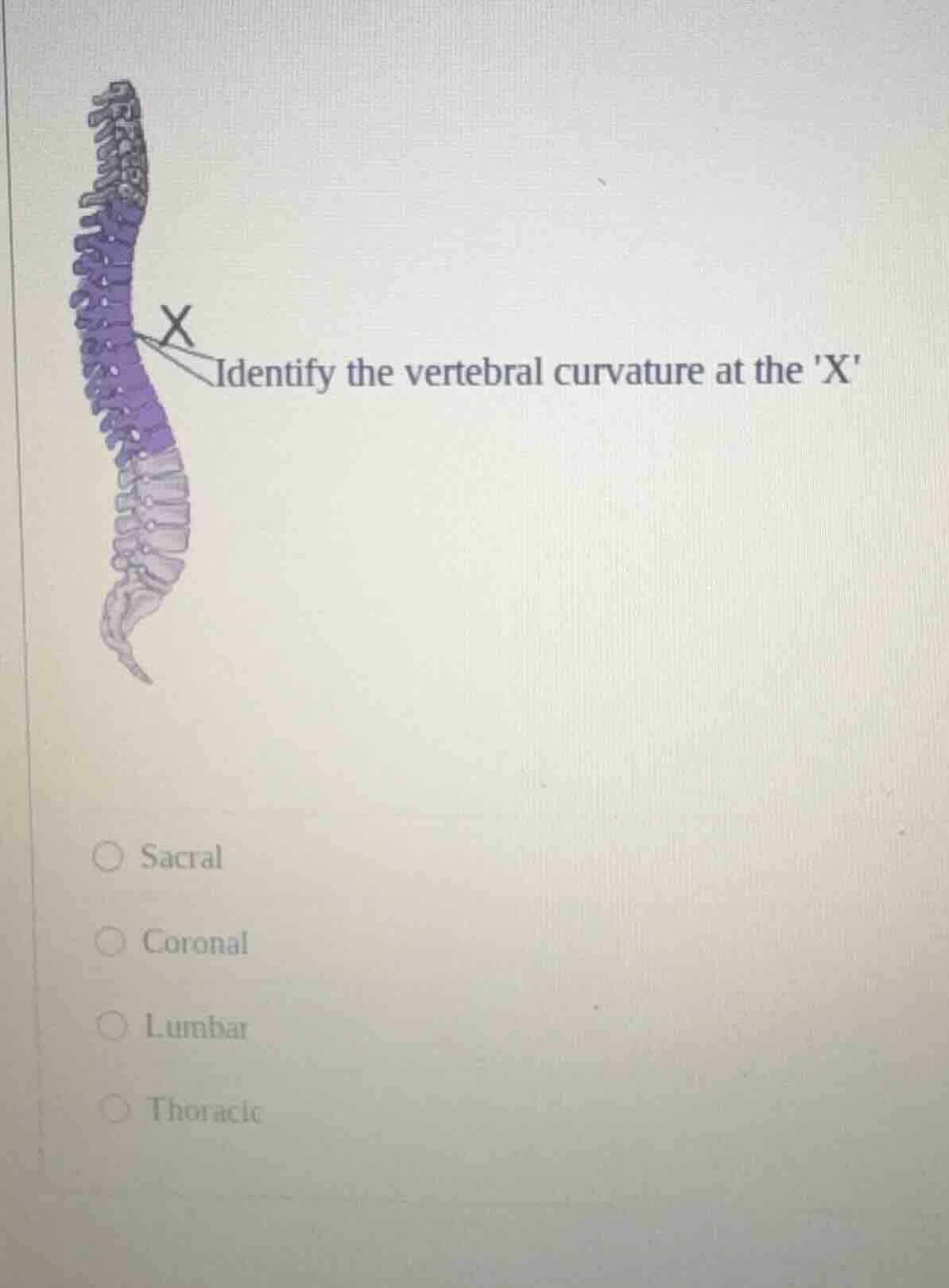 identify the vertebral curvature at the x○ sacral○ coronal○ lumbar○ tho…