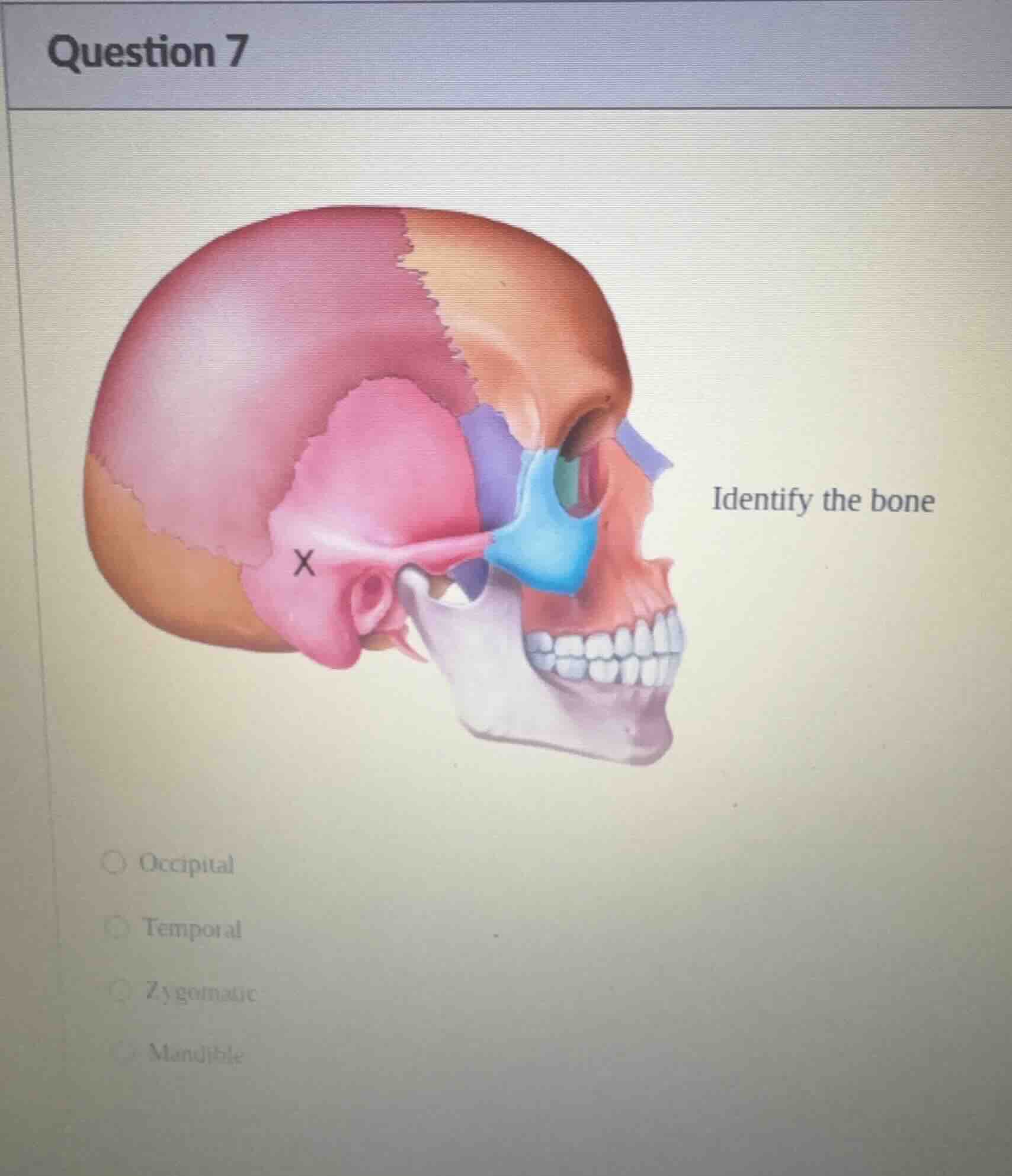 question 7 identify the bone occipital temporal zygomatic mandible