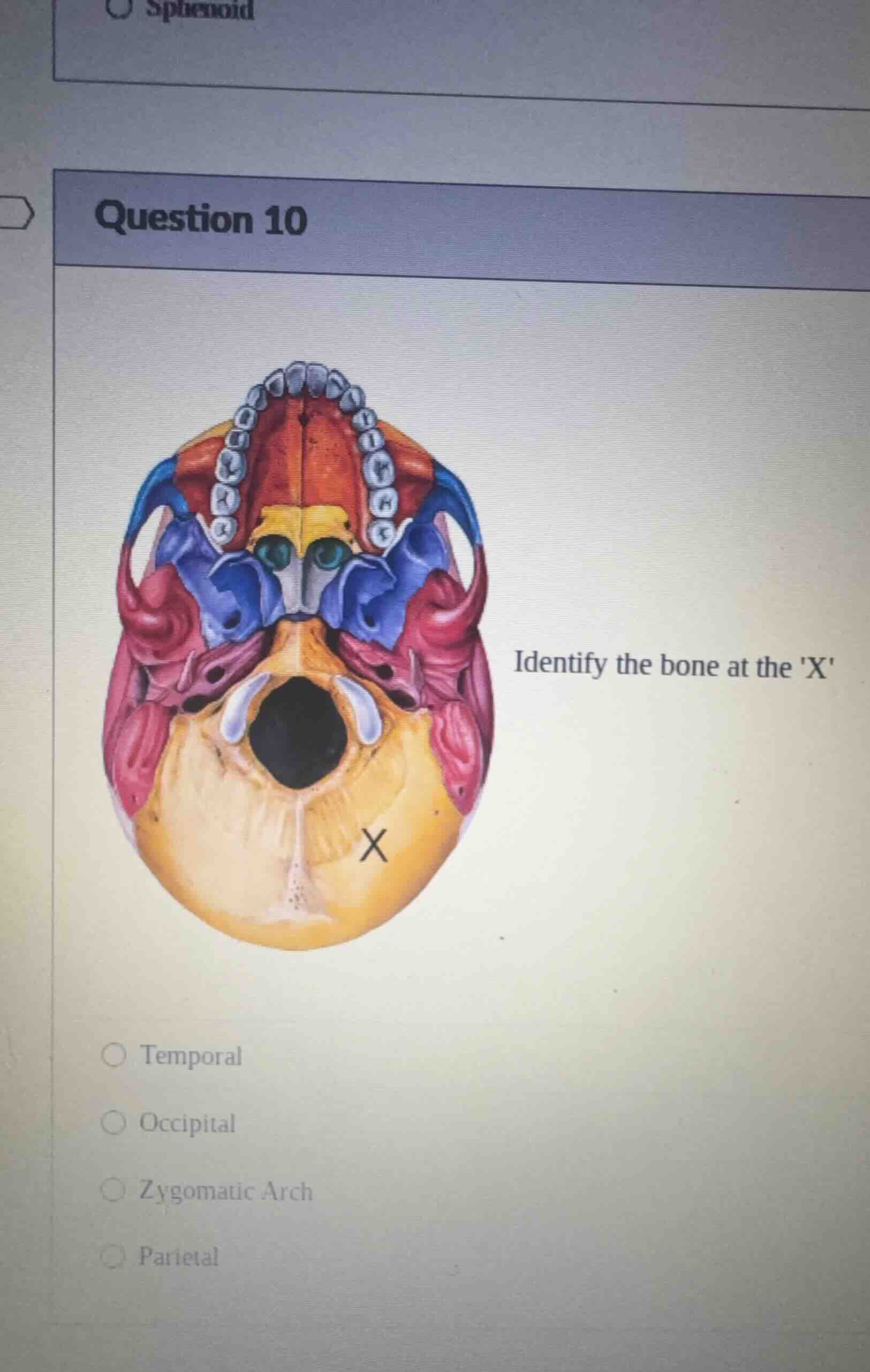 question 10 identify the bone at the x ○ temporal ○ occipital ○ zygomat…
