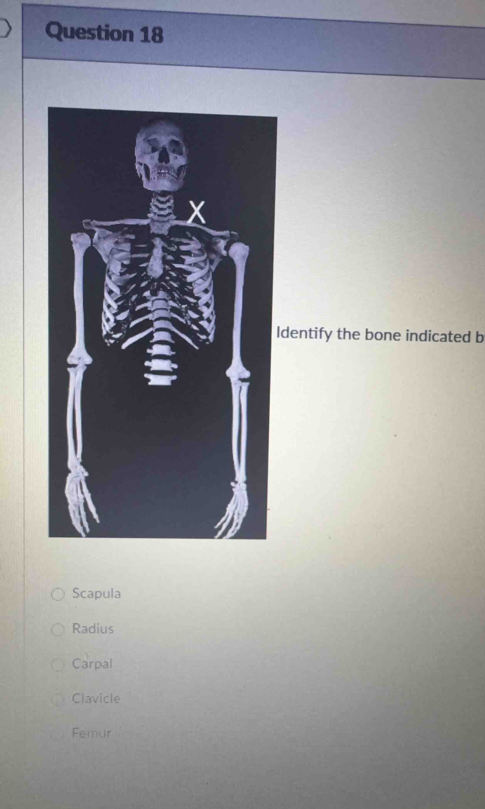 question 18 identify the bone indicated b scapula radius carpal clavicl…