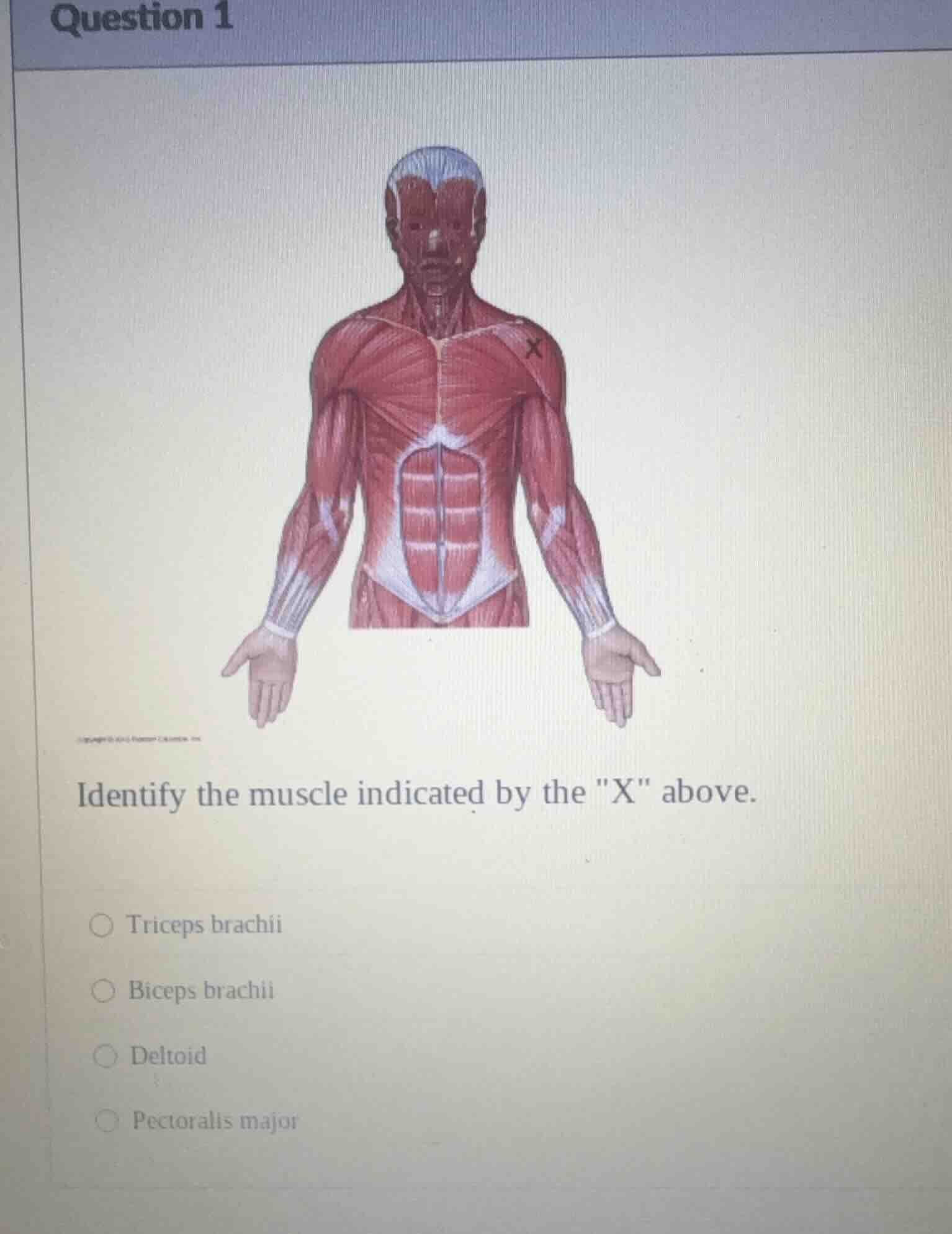 question 1 identify the muscle indicated by the \x\ above. ○ triceps br…