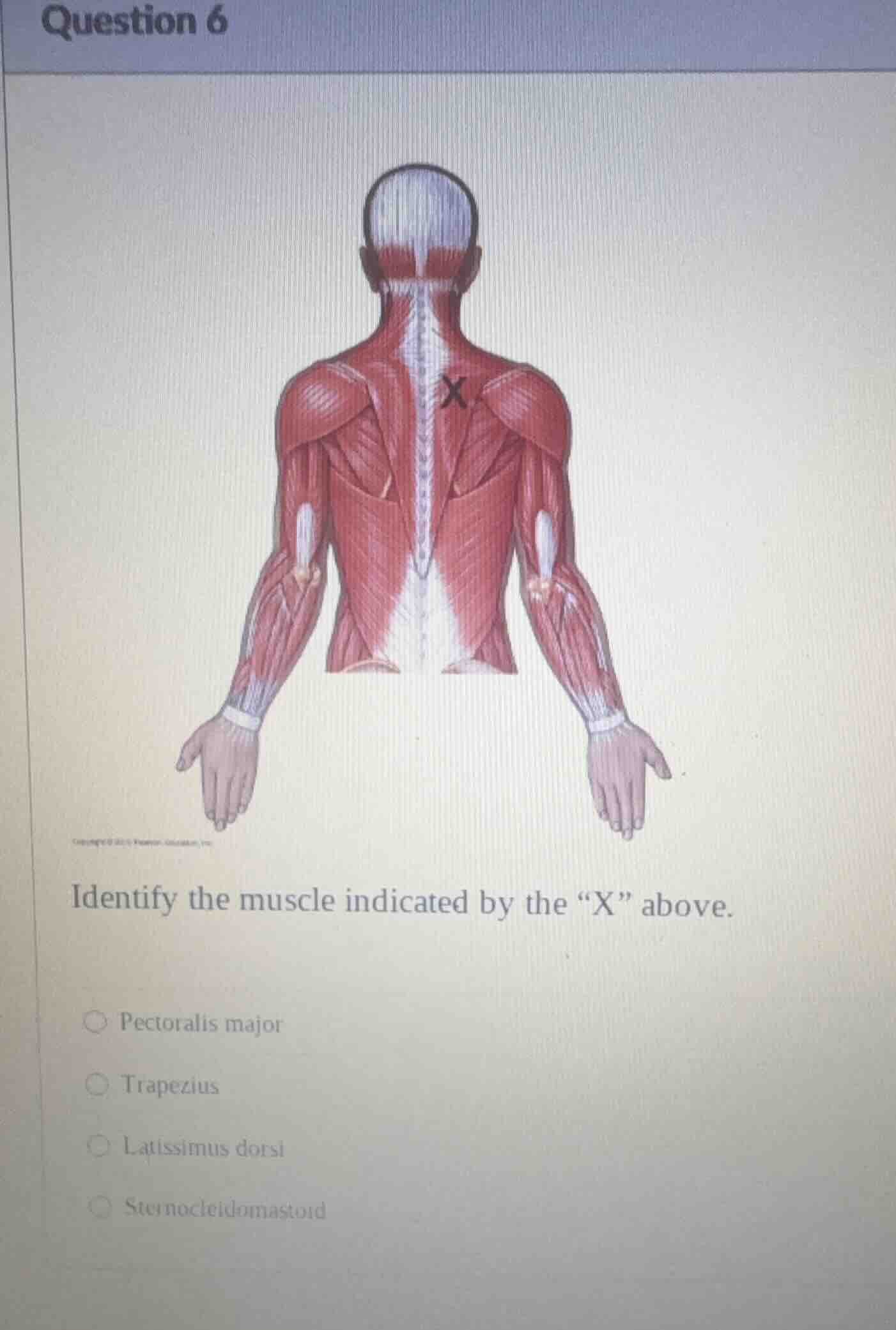 question 6 identify the muscle indicated by the “x” above. pectoralis m…