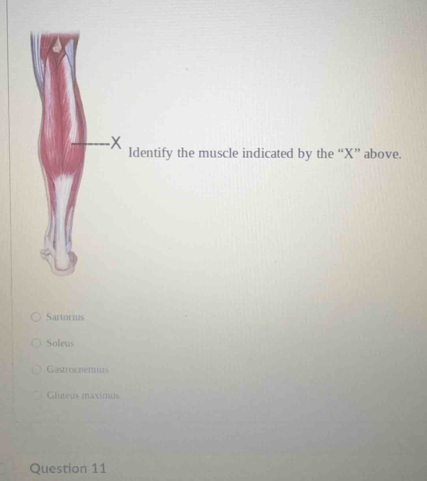 identify the muscle indicated by the “x” above. ○ sartorius ○ soleus ○ …