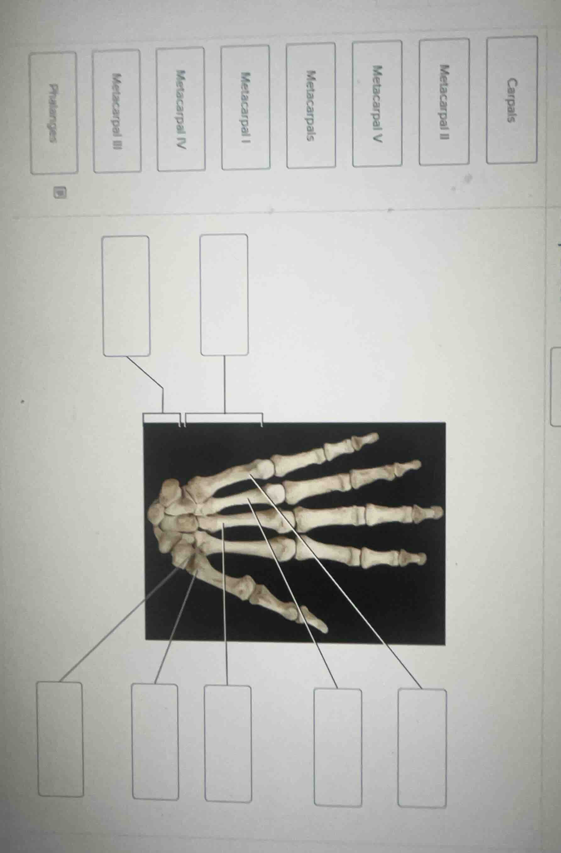 carpals\nmetacarpal ii\nmetacarpal v\nmetacarpals\nmetacarpal i\nmetacarpal iv\nmetacarpal iii\nphalanges