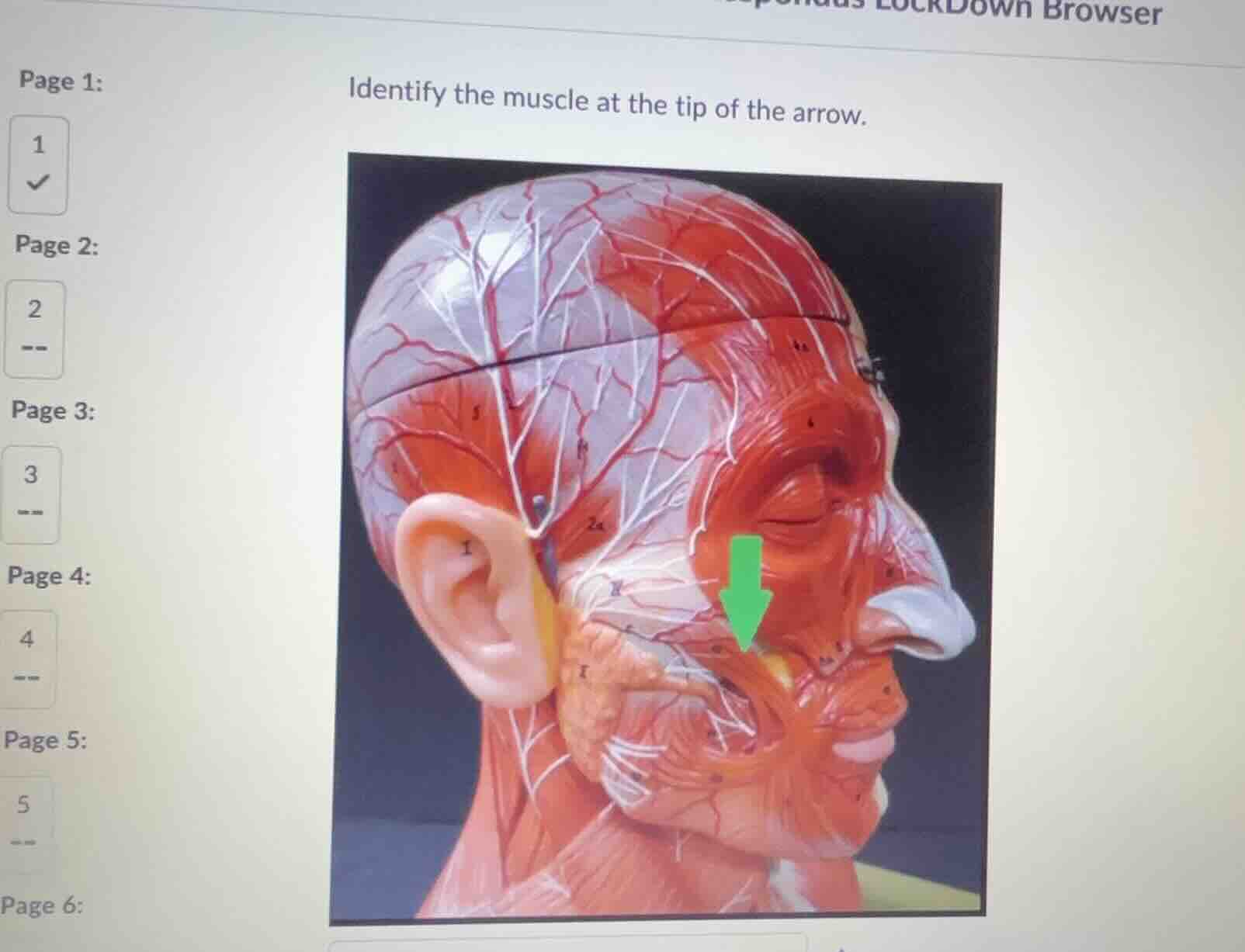 identify the muscle at the tip of the arrow.